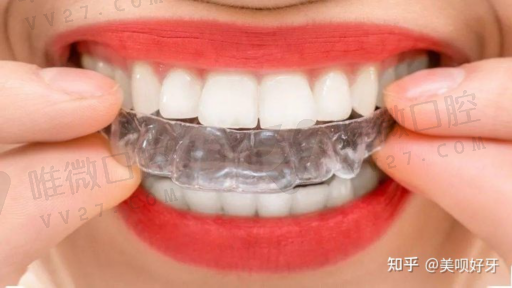 活动假牙与固定义齿的区别,活动义齿就是假牙吗(图1)